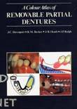 color atlas of removable partial dentures